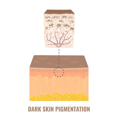 Melanin içeriği ve koyu ten fotokopisi dağılımı. Pigmentasyon mekanizması bilgi şeması. Epidermis enine kesiti yakın planda. Vektör illüstrasyonu.