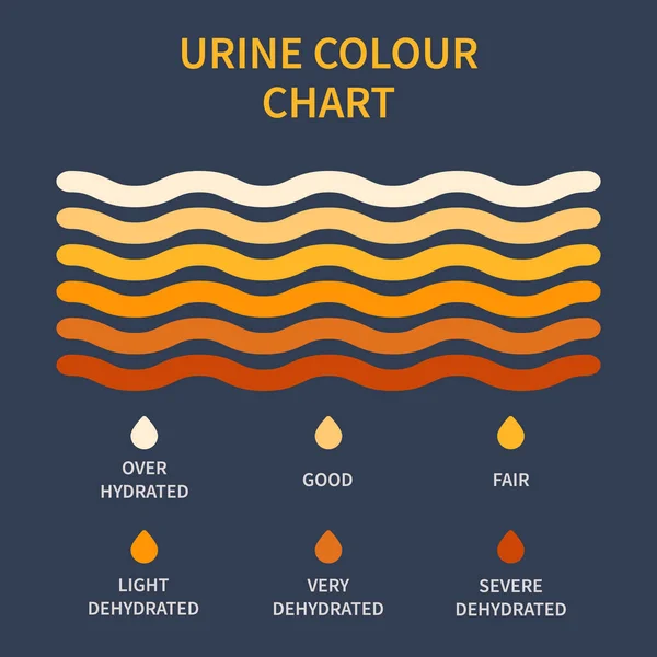Urine Colour Chart Hydration Dehydration Level Diagram Medical Urinal Test — Διανυσματικό Αρχείο