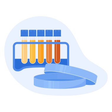 Urine colour chart. Hydration and dehydration level diagram. Medical urinal test kit for urinary tract infection research. Containers with yellow to brown pee for urinalysis. Vector illustration.