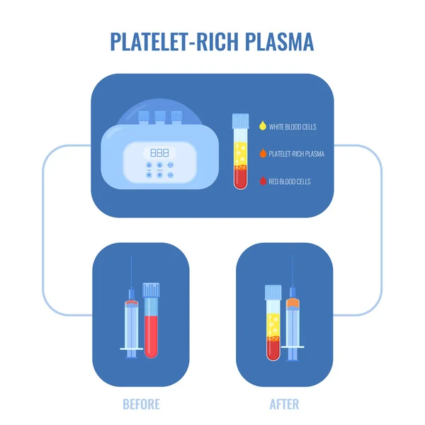 Blood Separation Platelets Centrifuge Prp Test Tube Laboratory Equipment Platelet — Vector de stock