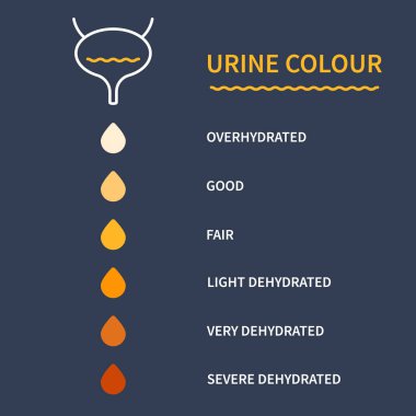 Urine color chart diagram. Bladder with urine drops showing different hydration level. Straw yellow to brown pee specimen. Medical concept. Vector illustration.