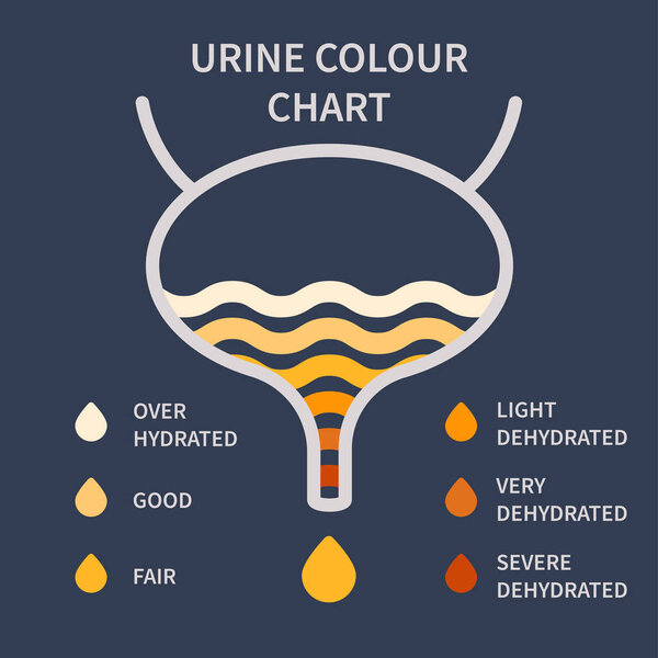 Urine color chart diagram. Bladder with urine drops showing different hydration level. Straw yellow to brown pee specimen. Medical concept. Vector illustration.