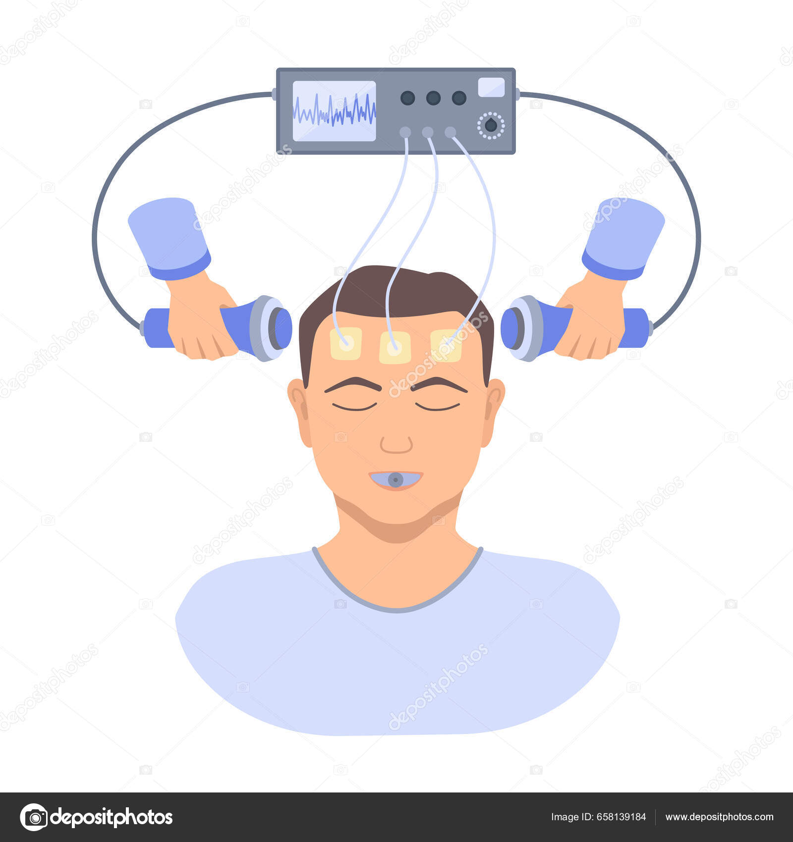 电休克疗法治疗严重抑郁症在男性病人身上放置电电极双相和严重抑郁症的脑刺激设备病媒医学说明图库矢量图©Naumas 658139184