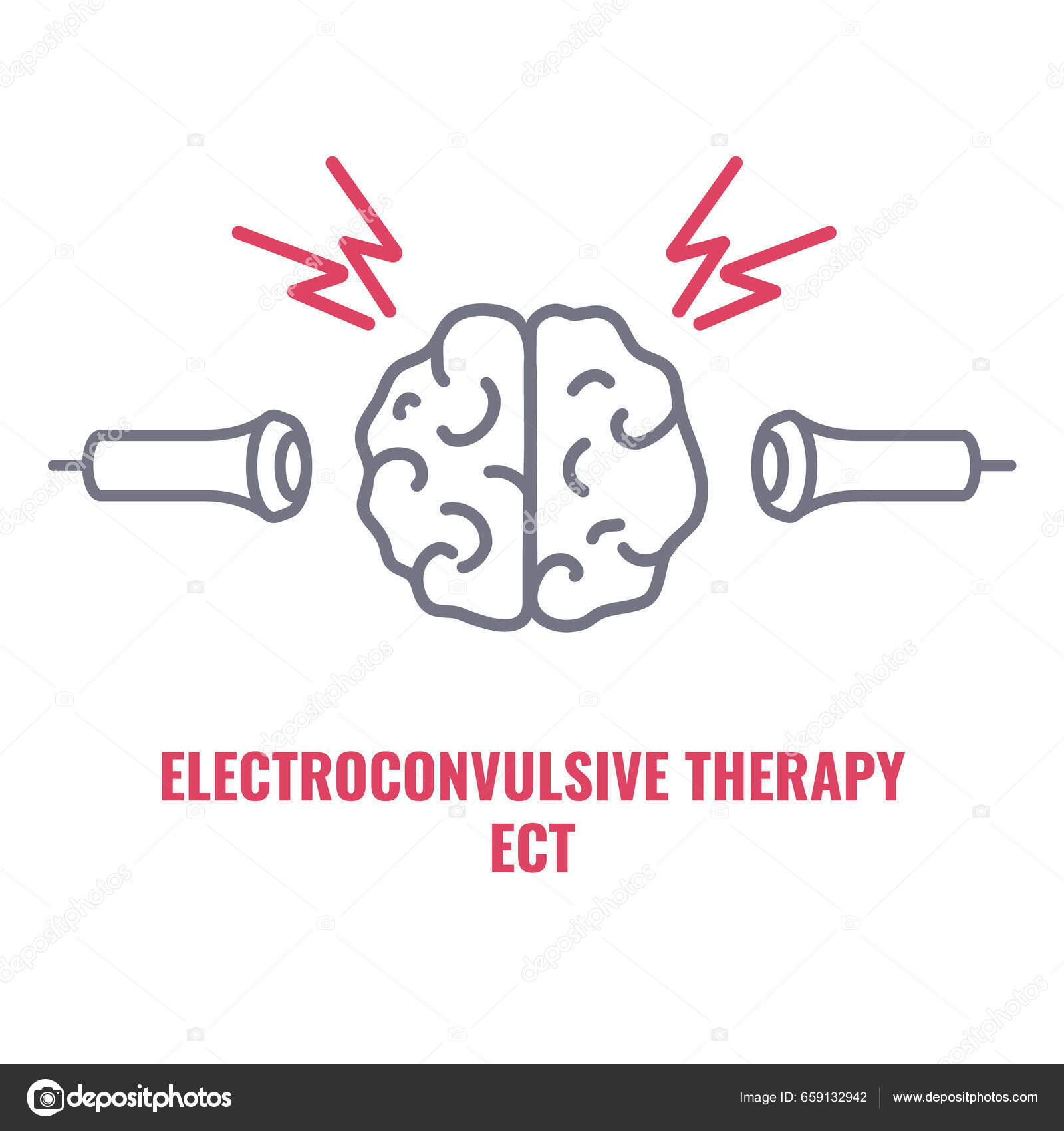 Electroconvulsive Therapy Severe Depression Schizophrenia Treatment Ect ...