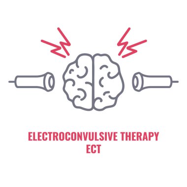 Şiddetli depresyon ve şizofreni tedavisi için elektrokonvülsif tedavi. Elektrotlar yerleştirildi. Manik depresif ve büyük depresif bozukluklar için beyin uyarma ekipmanları. Vektör illüstrasyonu.