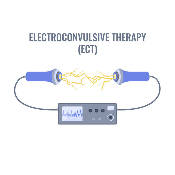 Электросудорожная терапия для тяжелой депрессии и лечения шизофрении. Размещение электродов. Оборудование для стимуляции мозга при биполярных и основных депрессивных расстройствах. Векторная иллюстрация.