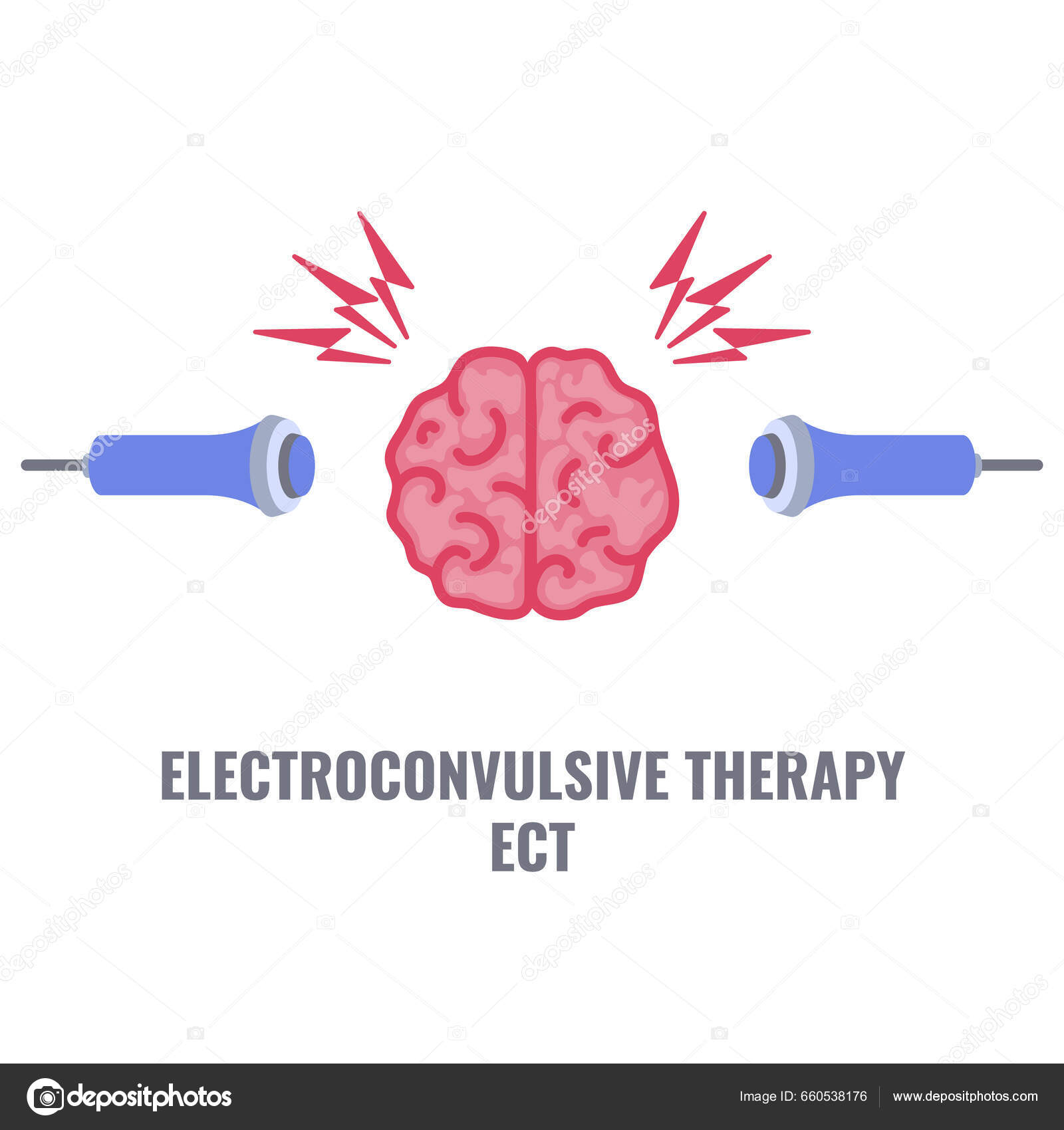 Electroconvulsive Therapy Severe Depression Schizophrenia Treatment Ect ...