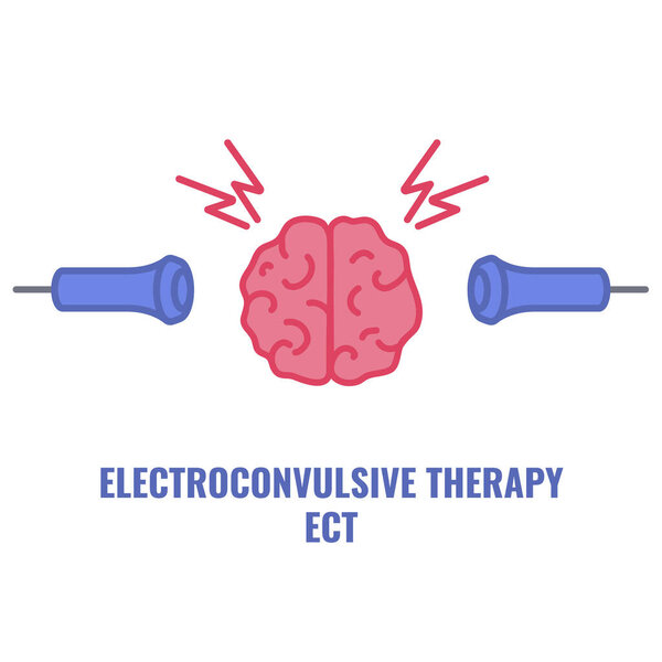 Электросудорожная терапия для тяжелой депрессии и лечения шизофрении. Размещение электродов. Оборудование для стимуляции мозга при биполярных и основных депрессивных расстройствах. Векторная иллюстрация.