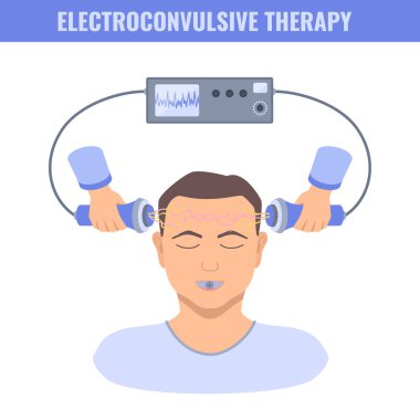 Electroconvulsive therapy for severe depression and schizophrenia treatment. ECT electrodes placement on a male patient. Brain stimulation equipment for major depressive disorders. Vector illustration clipart