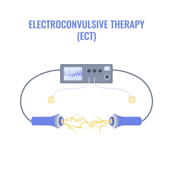 Электросудорожная терапия для тяжелой депрессии и лечения шизофрении. Размещение электродов. Оборудование для стимуляции мозга при биполярных и основных депрессивных расстройствах. Векторная иллюстрация.