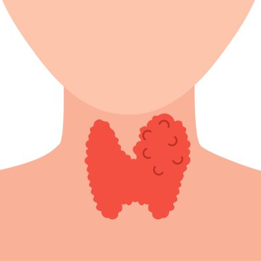 Tiroid bezi ikonu büyümüş. Yüzü olmayan vücut silueti. Tiroid hormonları destek veriyor. Hipertiroidizm ve hipotiroidizm hastalıkları. Metabolizma kontrolü. Vücut anatomisi. Vektör illüstrasyonu.