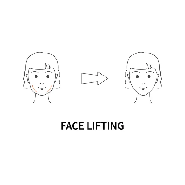 Facelifting anti-age treatment for women. Face skin tightening. Botox injections and laser therapy. Fine lines and wrinkles reduction. Beauty and rejuvenation concept. Linear vector illustration.