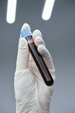 Arteriyel kan örneği. Yüksek kalite fotoğraf