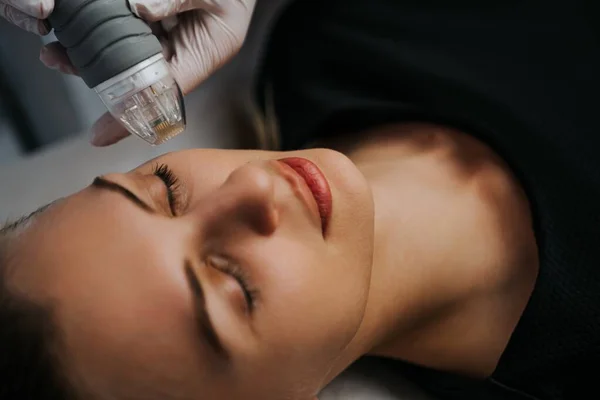 Microneedle Procedimento Elevação Cosmetologia Hardware Foto Alta Qualidade Imagens Royalty-Free