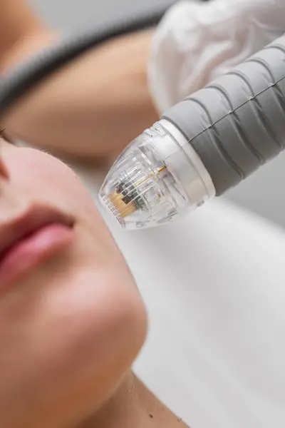 Mikroedle RF kaldırma prosedürü. Donanım kozmetolojisi. Yüksek kalite fotoğraf