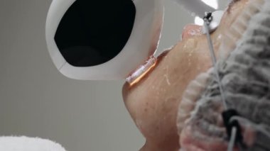 Bir profesyonel hasta kolundaki deriyi tedavi etmek için lazer uygular.