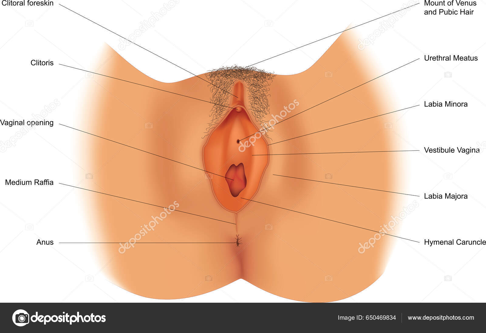 hymenal Hymen conservative techniques for vaginal surgery – a practical approach