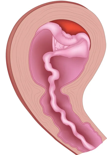 Plasental ayrılma ve kovulmanın vektör illüstrasyonu.