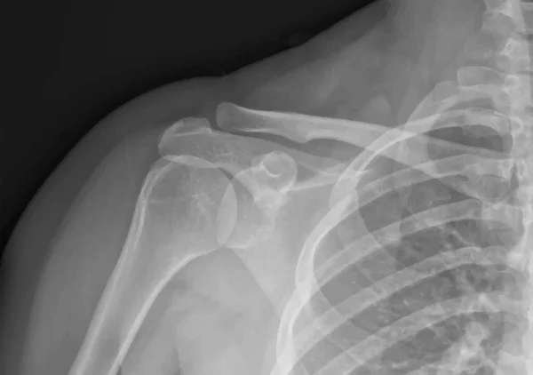 Плечовий Рентгенівський Промінь Медичних Досліджень Навчання Векторні Ілюстрації — стоковий вектор