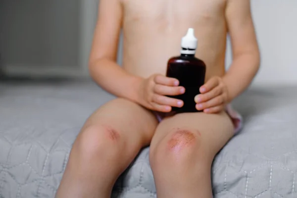 Helping Child Perform First Aid Knee Injury She Had Accident — Stock Photo, Image