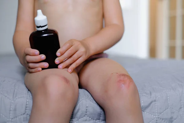 Children Injury Deep Scratches Skin Kids Knee Wounds Scratches Abrasions — Stock Photo, Image