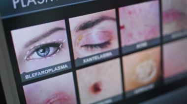 Bilinmeyen kozmetolojist, modern ekipmanlarla çalışıyor. Ekran seçimi türünü gençleştirme prosedürünü yakından takip ediyor. Doktor el, güzellik kliniğindeki blefaroplastia için tıbbi cihazları ayarlıyor..