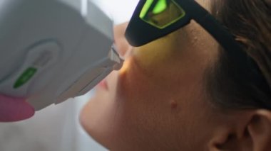 Modern kozmetoloji kliniğinde cilt yenileme. Kadın müşteri lazer cihazı kullanarak yüz kırışıklığı yaratıyor. Bilinmeyen kozmetolog güzellik salonunda yaşlanmayı önleme prosedürü uyguluyor.