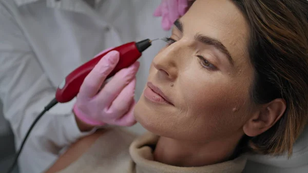 Innovative procedure removing mimic wrinkles attractive woman in clinic close up. Unknown doctor making plasmage using device with ultraviolet light. Non-surgery procedure in modern cosmetology salon.