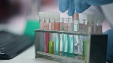 Tıp işçilerinin elleri cam test tüpleri alıp laboratuarda tıbbi deney yapıyorlar. Tanımlanamayan bilim adamı laboratuarda uyuşturucu örnekleri seçiyor. Eldivenli kimyager aşıyı kontrol ediyor.