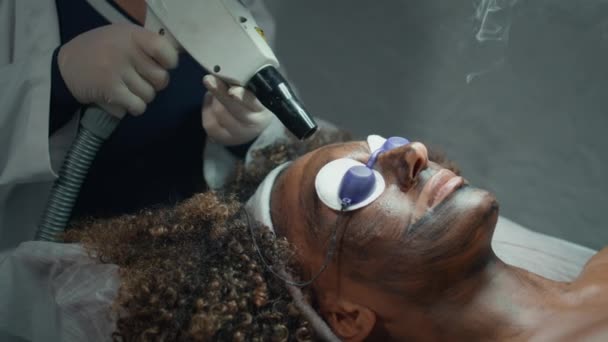 Schoonheidsspecialiste Schilferende Vrouwenhuid Met Laser Close Handen Met Salon Apparatuur — Stockvideo