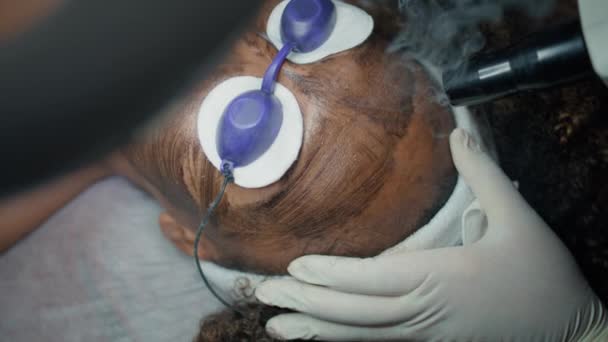 美容院的闭锁激光脉动面 非裔美国人做碳剥皮与护目镜 不知名的专业美容师治疗皱纹脱落的皮肤 审美年轻化程序 — 图库视频影像