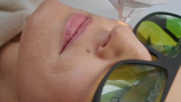 Modern Laser Hudvård Förfarande Ansiktsföryngring Skönhetssalong Vertikalt Orienterade Närbild Kvinnlig — Stockvideo