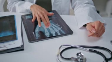 Doktor elleri klinikteki dijital tablette röntgene dokunuyor. Tanımlanamayan sağlık hizmeti uzmanı tıbbi görüntüleri inceliyor. Uzman doktor teşhis için radyoloji sonuçlarını inceliyor..