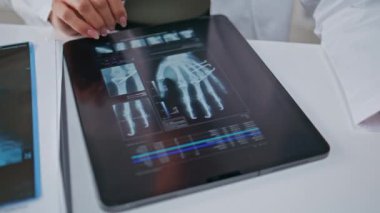 Radyolog klinikteki dijital tablette el röntgeni görüntülerini inceliyor. Bilinmeyen sağlık uzmanı kemik yapısını analiz ediyor. Radyografik muayene yapan kadın tıp uzmanı..