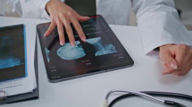 Hastane ofisindeki tablette kafatasının röntgenini inceleyen doktor. Bilinmeyen doktor elleri radyoloji görüntülerinin ekran iletim analizine dokunuyor. Radyolog kemik yapısını teknolojiyle değerlendiriyor.