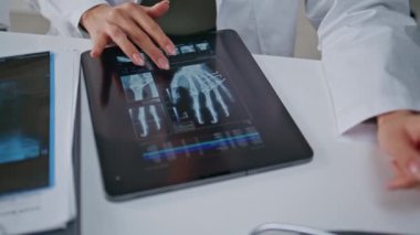 Sıhhiyeciler klinikteki tablet üzerindeki kol röntgenlerini inceliyor. Kadın doktor dijital olarak gösterilen radyografları profesyonel olarak inceliyor. Modern teknolojiyle tıbbi uzmanlık kemiği