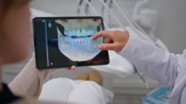 Dişçilerin elleri stomatoloji kliniğindeki muayenede tabletin üzerinde röntgen tutuyor. Bilinmeyen kadın doktor diş tedavisini tartışan dijital görüntüleri analiz ediyor. Profesyonel stomatolog randevusu..