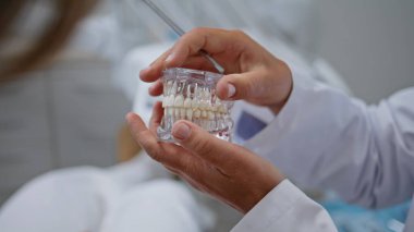Dişçi elleri, stomatoloji kliniğinde diş modelini tutuyor. Bilinmeyen kadın doktor diş hekimliği randevusunda tedavi prosedürünü açıklayan dişlere işaret ediyor. Beyaz cüppeli ortodontist danışmanlık