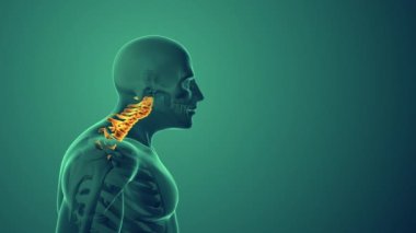 Servikal duruş sendromu veya boyun ağrısı tıbbi geçmişi