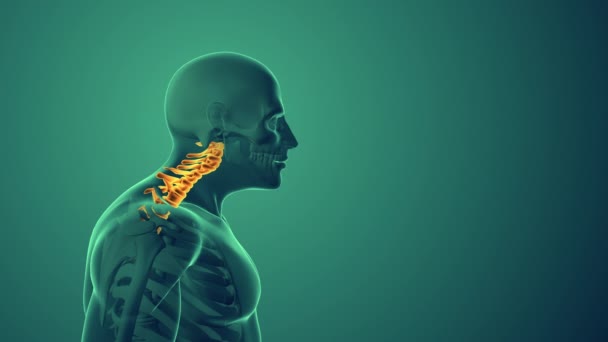 子宮頸部姿勢症候群または首痛医学的背景 — ストック動画