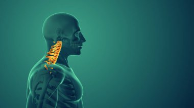 Servikal duruş sendromu veya boyun ağrısı tıbbi geçmişi