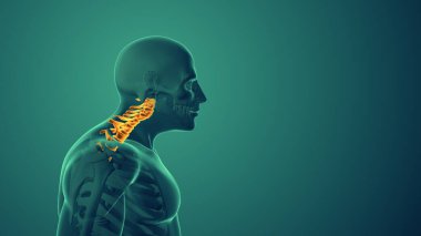 Servikal duruş sendromu veya boyun ağrısı tıbbi geçmişi