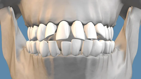 Nozione Odontoiatria Trattamento Ortodontico — Foto Stock