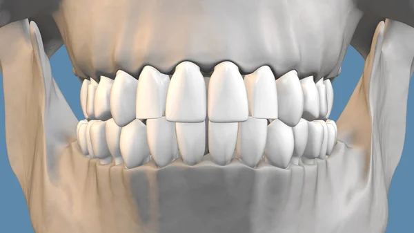 歯と歯列矯正治療の概念 — ストック写真