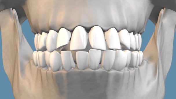 Koncepce Zubní Ortodontické Léčby — Stock video