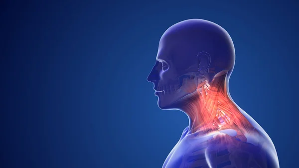 stock image Cervical postural syndrome or neck pain