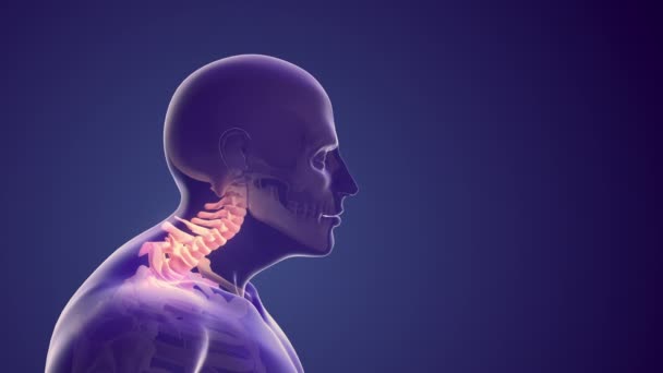 Sindrome Della Postura Cervicale Fastidio Collo — Video Stock
