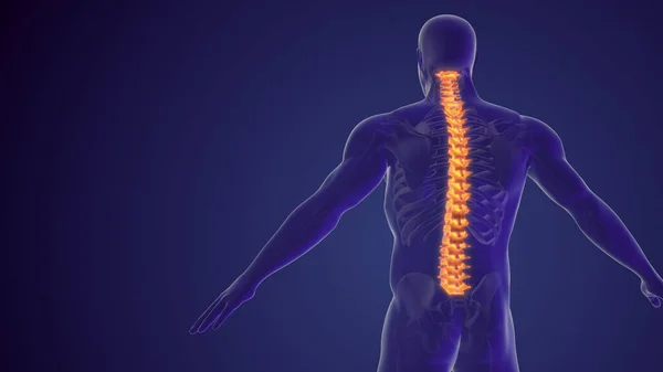 脊髓疼痛或背痛 — 图库照片
