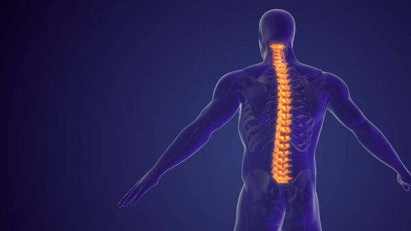 Spinal pain or back pain