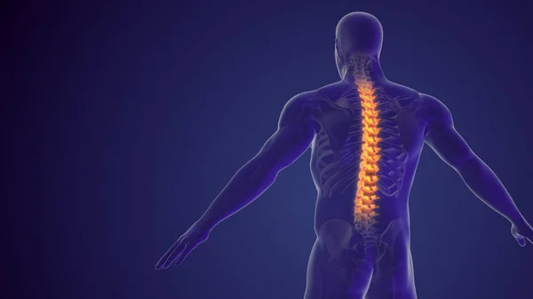 脊髓疼痛或背痛医学背景 — 图库照片